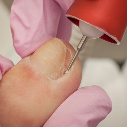 Mobile Foot Care