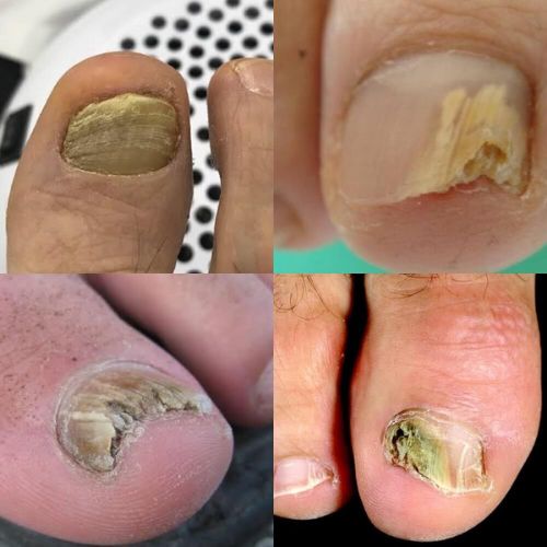 Mobile Foot Care
